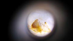 Meotipa spiniventris