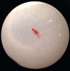 Pediculus humanus capitis