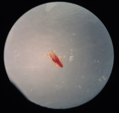 Pediculus humanus capitis