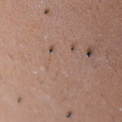 Arthropoda