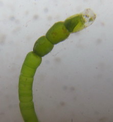Chaetomorpha spiralis