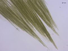 Aphanizomenon flosaquae
