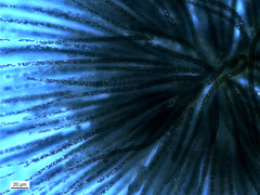 Gloeotrichia echinulata