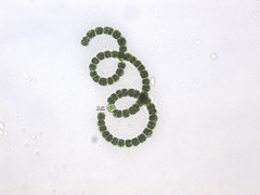 Dolichospermum crassum