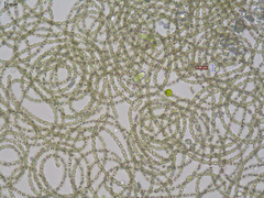Dolichospermum
