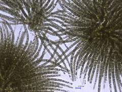 Gloeotrichia echinulata