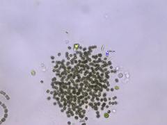 Microcystis