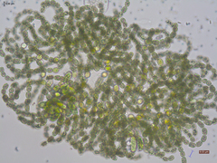 Dolichospermum