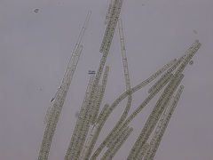 Aphanizomenon flosaquae