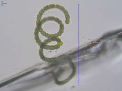 Dolichospermum crassum