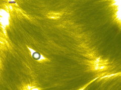Aphanizomenon flosaquae