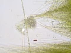 Aphanizomenon flosaquae