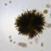 Gloeotrichia echinulata - Photo (c) Kyle Kerger,  זכויות יוצרים חלקיות (CC BY-NC), הועלה על ידי Kyle Kerger