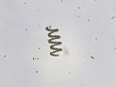 Dolichospermum crassum