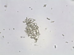 Dolichospermum