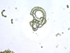 Dolichospermum