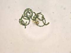 Dolichospermum
