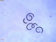 Dolichospermum crassum