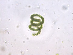 Dolichospermum crassum