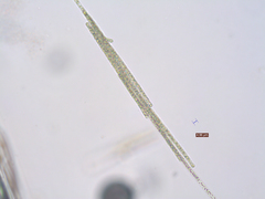 Aphanizomenon flosaquae