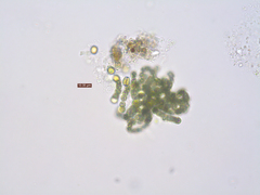Dolichospermum
