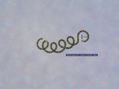 Dolichospermum crassum