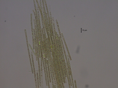 Aphanizomenon flosaquae