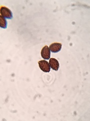 Lacrymaria lacrymabunda