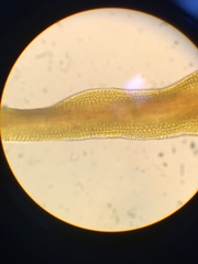 Vinealobryum vineale