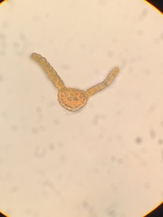 Vinealobryum vineale