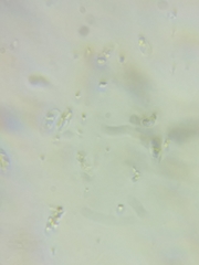 Phanerochaete livescens