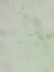 Phanerochaete livescens