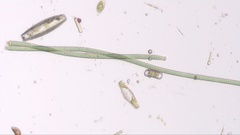 Nodularia