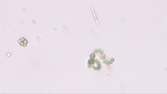 Anabaena