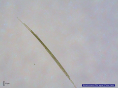 Aphanizomenon flosaquae