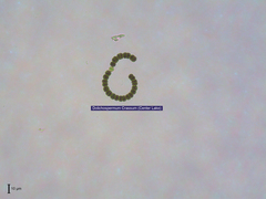 Dolichospermum crassum