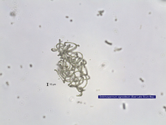 Dolichospermum