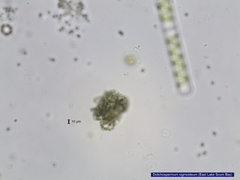 Dolichospermum