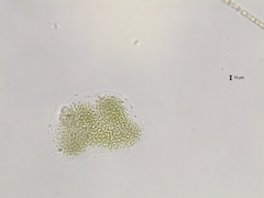 Microcystis flos-aquae