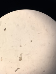 Conochilus hippocrepis