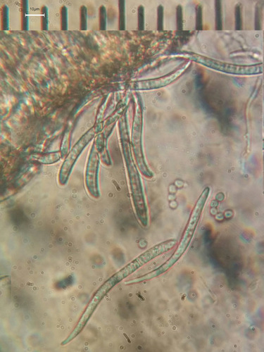 Gabura fascicularis