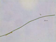 Dolichospermum