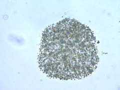 Microcystis flos-aquae