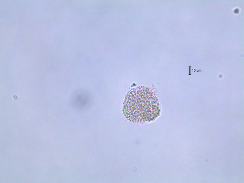 Polycystis, 2016-07-14