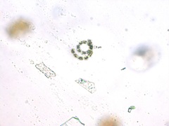 Dolichospermum