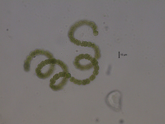 Dolichospermum crassum