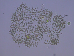 Microcystis smithii