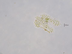 Microcystis wesenbergii