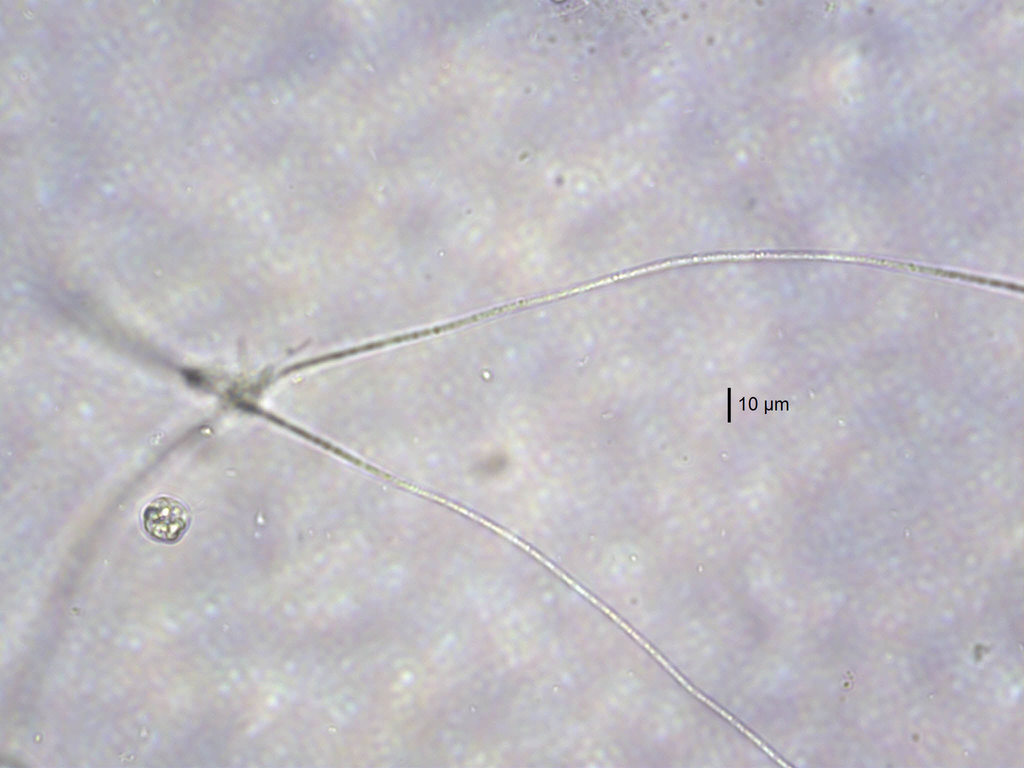 Limnothrix