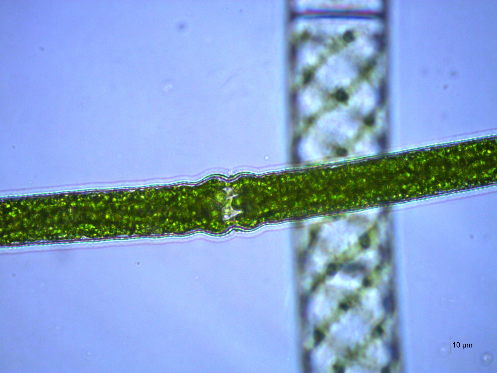 Pleurotaenium